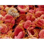 Coagulation