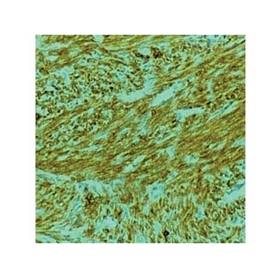 Actin, alpha smooth muscle , 1A4 , IgG2a - 1ml
