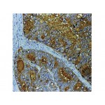 CEA , Col-1 , IgG2a - 0.5ml