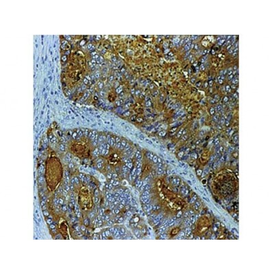 CEA , Col-1 , IgG2a - 0.5ml