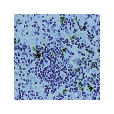 Ki-1 Antigen, CD30 , Ber-H2 , IgG1 - 1ml Ki-1 Antigen, CD30 , Ber-H2 , IgG1 - 1ml