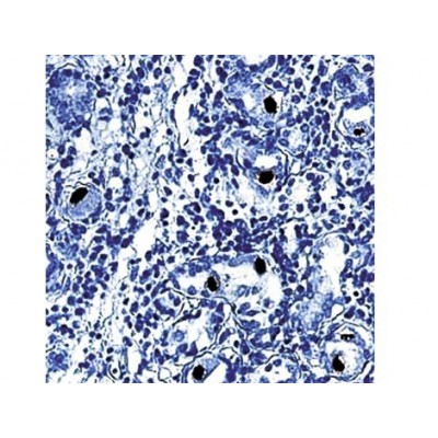 CMV Cocktail , DDG9+CCH2 , IgG2a+IgG1 - 0.5ml