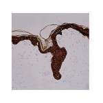 Cytokeratin (45, 56 & 58 kD) , LP34 , IgG1 - 0.5ml