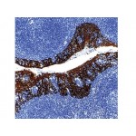 Cytokeratin (45,46,56.4 kD) , MNF116 , IgG1 - 0.5ml