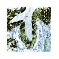 Cytokeratin 8 , 35bH11 , IgM - 1ml Cytokeratin 8 , 35bH11 , IgM - 1ml