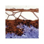 Cytokeratin 10 (56.5 kD) , DE-K10 , IgG1 - 0.5ml