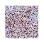 Desmin , D33 , IgG1 - 0.5ml
