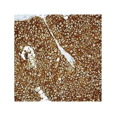 Epithelial Antigen , VU-1D9 , IgG1 - 1ml