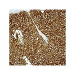 EMA , GP1.4 , IgG1 - 0.5ml