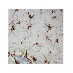 GFAP , GA5 , IgG1 - 0.5ml