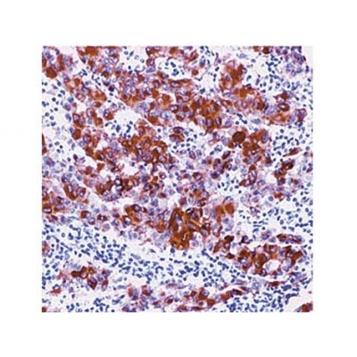 Melanoma , HMB45 , IgG1 - 0.5ml