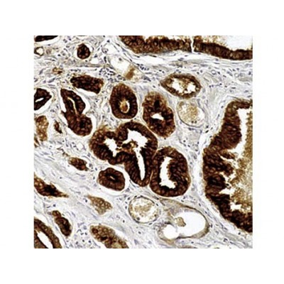 PSA , ER-PR8 , IgG1 - 0.5ml PSA , ER-PR8 , IgG1 - 0.5ml