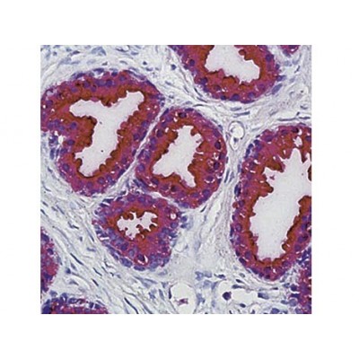 PSAP , PASE/4LJ , IgG1 - 1ml PSAP , PASE/4LJ , IgG1 - 1ml