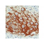 Cytokeratin 17 , E3 , IgG2b - 0.5ml