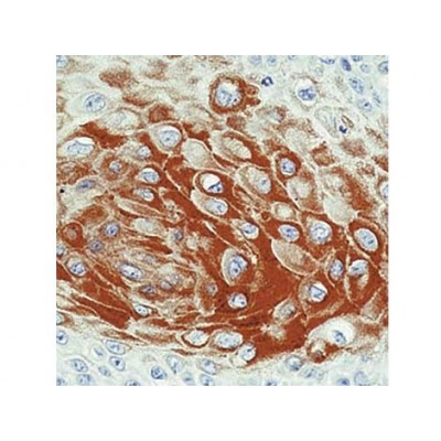 Cytokeratin 17 , E3 , IgG2b - 0.5ml