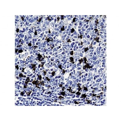 CD57, HNK-1 , NK-1 , IgM - 0.5ml