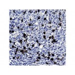 CD57, HNK-1 , NK-1 , IgM - 1ml