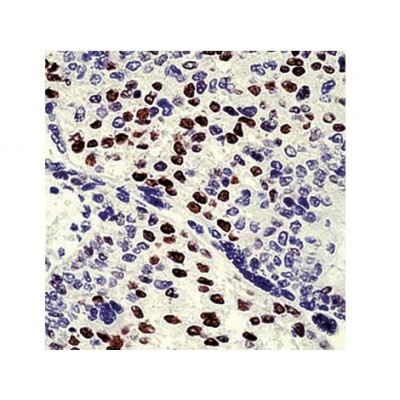 Cyclin E , 13A3 , IgG2a - 0.5ml