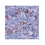 Cytokeratin 5/8 , C50 , IgG1 - 0.5ml