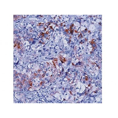 Cytokeratin 5/8 , C50 , IgG1 - 1ml