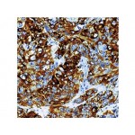 Monoclonal Mouse AntiboCytokeratin 14 , LL002 , IgG3 - 0.5ml Monoclonal Mouse AntiboCytokeratin 14 , LL002 , IgG3 - 0.5ml