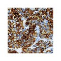 Cytokeratin 14 , LL002 , IgG3 - 1ml