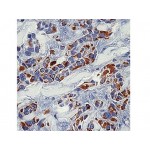 Cytokeratin 18 , DC10 , IgG1 - 0.5ml