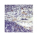 Factor VIII , F8/86 , IgG1 - 1ml