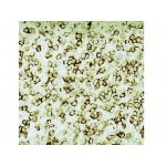 Hairy Cell Leukemia , DBA.44 , IgM - 0.5ml