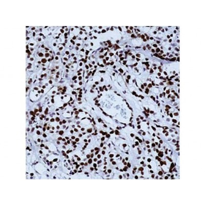 Retinoblastoma Protein , 1F8 , IgG1 - 0.5ml