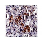 ACTH , AH26 , IgG1 - 1ml