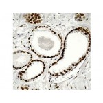 Androgen Receptor , AR 441 , IgG1 - 0.5ml