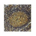 CD25, IL2 Receptor , IL2R.1 , IgG1 - 1ml