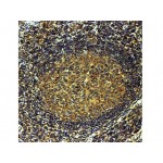 CD25, IL2 Receptor , IL2R.1 , IgG1 - 1ml