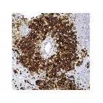 CD99/MIC2 , HO36-1.1 , IgM - 0.5ml