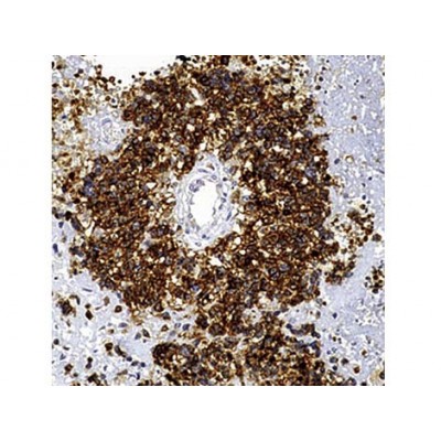 CD99/MIC2 , HO36-1.1 , IgM - 1ml