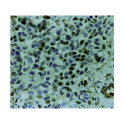 Cyclin E , HE12 , IgG1 - 1ml