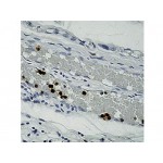 Granulocyte , BM-2 , IgG1 - 0.5ml
