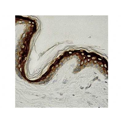 Involucrin , SY5 , IgG1 - 0.5ml