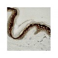 Involucrin , SY5 , IgG1 - 1ml