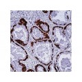 Cytokeratin H.M.W. , DE-SQ , IgG1 - 0.5ml
