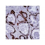 Cytokeratin H.M.W. , DE-SQ , IgG1 - 0.5ml