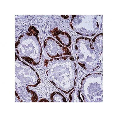 Cytokeratin H.M.W. , DE-SQ , IgG1 - 0.5ml