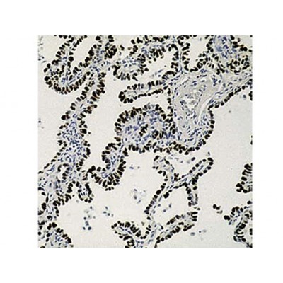 TTF-1 , 8G7G3/1 , IgG1 - 0.5ml TTF-1 , 8G7G3/1 , IgG1 - 0.5ml