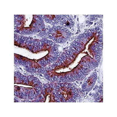 TAG-72 , B72.3 , IgG1 - 1ml