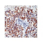 Tyrosinase , T311 , IgG1 - 1ml