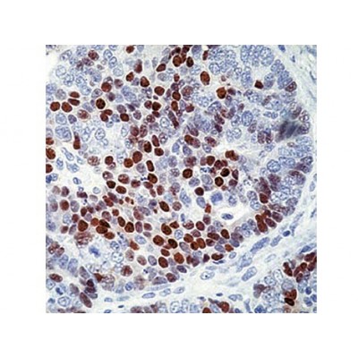 p57KIP2 , 57P06 , IgG2b - 0.5ml