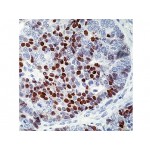 p57KIP2 , 57P06 , IgG2b - 1ml