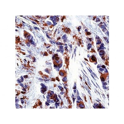 Monoclonal Thymidine Phosphorylase , P-GF.44C , IgG1 - 0.5ml