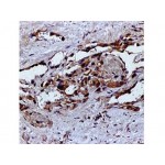 Vascular Endothelial GF , VG1 , IgG1 - 0.5ml